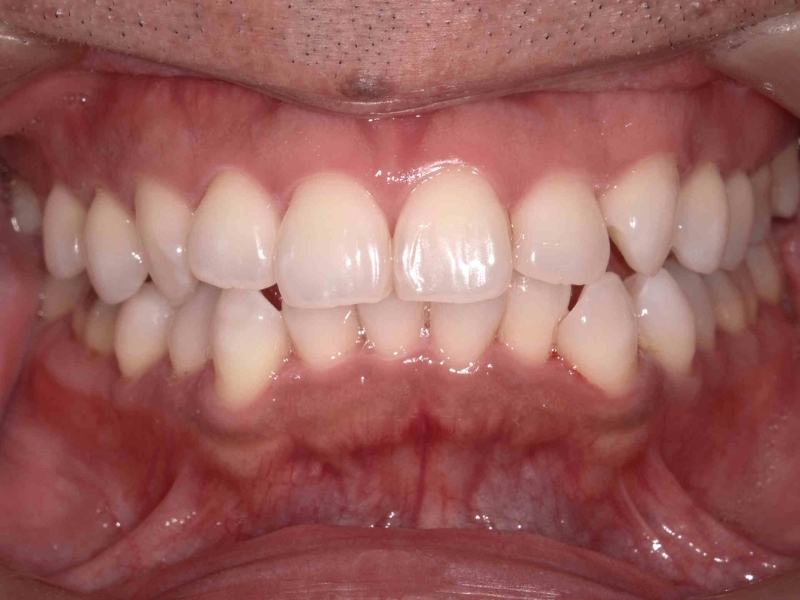 ＜症例5＞米原起夫さん